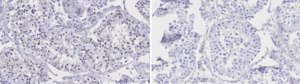 Anti-HDAC11 Antibody, clone 1E11 ZooMAb® Rabbit Monoclonal recombinant, expressed in HEK 293 cells