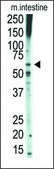 Anti-TGFBR1 (center) antibody produced in rabbit IgG fraction of antiserum, buffered aqueous solution