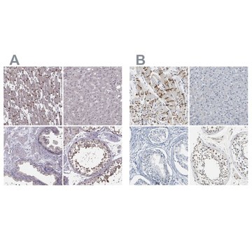 Anti-PKP2 antibody produced in rabbit Prestige Antibodies® Powered by Atlas Antibodies, affinity isolated antibody