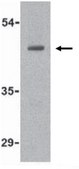 Anti-ATR Antibody from rabbit, purified by affinity chromatography