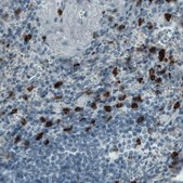 Monoclonal Anti-MMP9 antibody produced in mouse Prestige Antibodies® Powered by Atlas Antibodies, clone CL0542, purified immunoglobulin, buffered aqueous glycerol solution