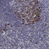Anti-TYMS antibody produced in rabbit Prestige Antibodies® Powered by Atlas Antibodies, affinity isolated antibody, buffered aqueous glycerol solution