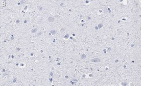 Anti-GAP43 Antibody, clone 1D6 , ZooMAb® Rabbit Monoclonal recombinant, expressed in HEK 293 cells
