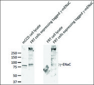 Anti-SCNN1G antibody produced in rabbit 1 mg/mL, affinity isolated antibody