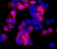 单克隆抗-c-Myc 小鼠抗 clone 9E10, ascites fluid