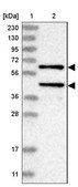 Anti-PPM1A antibody produced in rabbit Prestige Antibodies® Powered by Atlas Antibodies, affinity isolated antibody, buffered aqueous glycerol solution