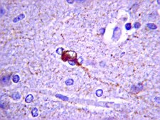 Anti-Somatostatin Antibody, clone YC7 culture supernatant, clone YC7, Chemicon®