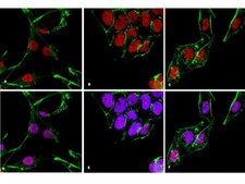 Anti-SMAD1 Antibody, clone AS22 clone AS22, from mouse