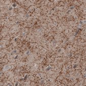 Monoclonal Anti-MOG antibody produced in mouse Prestige Antibodies® Powered by Atlas Antibodies, clone CL2852, purified immunoglobulin, buffered aqueous glycerol solution