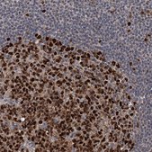 Anti-PCNA antibody produced in rabbit Prestige Antibodies® Powered by Atlas Antibodies, affinity isolated antibody, buffered aqueous glycerol solution, ab2