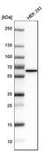 Anti-STK3 antibody produced in rabbit Prestige Antibodies® Powered by Atlas Antibodies, affinity isolated antibody, buffered aqueous glycerol solution