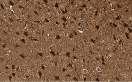 Anti-p44 MAPK (ERK1) Antibody, clone 13F10, ZooMAb® Rabbit Monoclonal recombinant, expressed in HEK 293 cells