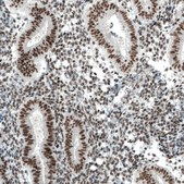 Monoclonal Anti-PBRM1 antibody produced in mouse Prestige Antibodies® Powered by Atlas Antibodies, clone CL0331, purified immunoglobulin, buffered aqueous glycerol solution