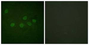 Anti-CBP antibody produced in rabbit affinity isolated antibody
