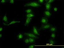 Monoclonal Anti-AKR1B10 antibody produced in mouse clone 1A6, purified immunoglobulin, buffered aqueous solution