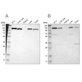 Anti-PITRM1 antibody produced in rabbit Ab2, Prestige Antibodies® Powered by Atlas Antibodies, affinity isolated antibody, buffered aqueous glycerol solution