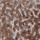 Monoclonal Anti-HMGCR antibody produced in mouse Prestige Antibodies® Powered by Atlas Antibodies, clone CL0259, purified immunoglobulin, buffered aqueous glycerol solution