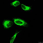 Anti-APP A4 Antibody, a.a. 66-81 of APP {NT}, clone 22C11 clone 22C11, Chemicon®, from mouse