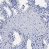 Anti-HAPLN1 antibody produced in rabbit Prestige Antibodies® Powered by Atlas Antibodies, affinity isolated antibody, buffered aqueous glycerol solution, Ab2