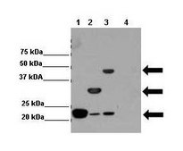 Anti-ATXN3, (N-terminal) antibody produced in rabbit affinity isolated antibody