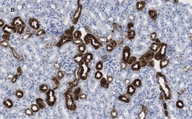 Anti-Calbindin D-28K clone 1A11 Antibody, ZooMAb® Rabbit Monoclonal recombinant, expressed in HEK 293 cells