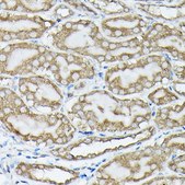 Anti-Phospho-KRAS-S89 antibody produced in rabbit