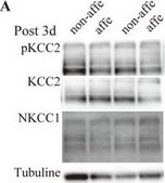 Anti-K+/Cl- Cotransporter (KCC2) Antibody Upstate®, from rabbit