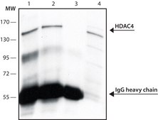 Anti-Histone Deacetylase 4 (HDAC4) (DM-15) antibody produced in rabbit affinity isolated antibody, buffered aqueous solution