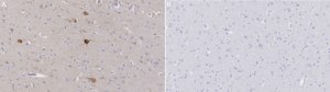Anti-CHRNA7 Antibody, clone 1K16 ZooMAb® Rabbit Monoclonal recombinant, expressed in HEK 293 cells