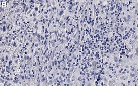 Anti-p-Rb-Ser807/811 Antibody, clone 3J7 ZooMAb® Rabbit Monoclonal recombinant, expressed in HEK 293 cells
