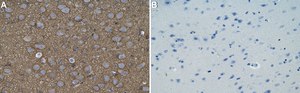 Anti-Tau Antibody, clone T49 ZooMAb® Mouse Monoclonal recombinant, expressed in HEK 293 cells