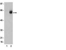 Anti-Estrogen Receptor β Antibody, clone 68-4, rabbit monoclonal culture supernatant, clone 68-4, from rabbit
