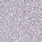 Anti-PRSS37 antibody produced in rabbit Prestige Antibodies® Powered by Atlas Antibodies, affinity isolated antibody, buffered aqueous glycerol solution