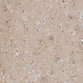 Anti-GPER1 antibody produced in rabbit Prestige Antibodies® Powered by Atlas Antibodies, affinity isolated antibody, buffered aqueous glycerol solution