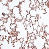 Anti-Vimentin antibody produced in rabbit