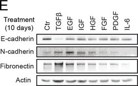 Anti-Fibronectin antibody produced in rabbit affinity isolated antibody, buffered aqueous solution