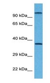Anti-G6PC antibody produced in rabbit affinity isolated antibody
