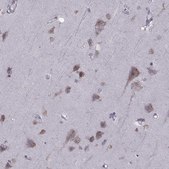 Anti-PABPC1 antibody produced in rabbit Prestige Antibodies® Powered by Atlas Antibodies, affinity isolated antibody, buffered aqueous glycerol solution