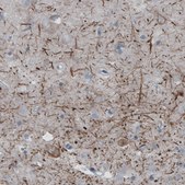 Monoclonal Anti-NEFH antibody produced in mouse Prestige Antibodies® Powered by Atlas Antibodies, clone CL2671, purified immunoglobulin, buffered aqueous glycerol solution