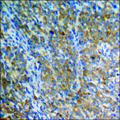 抗 磷酸-CaMK2 (pThr 286 ) 兔抗 affinity isolated antibody