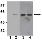 Anti-phospho-Akt1/PKBα (Ser473) Antibody, clone SK703, rabbit monoclonal culture supernatant, clone SK703, Upstate®