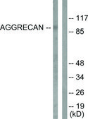 Anti-Aggrecan (Cleaved-Asp369), N-Terminal antibody produced in rabbit affinity isolated antibody