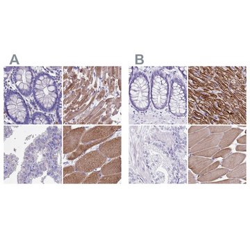 Anti-SRL antibody produced in rabbit Prestige Antibodies® Powered by Atlas Antibodies, affinity isolated antibody, buffered aqueous glycerol solution
