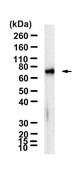 Anti-ZAP-70 Antibody, clone 1D9 ZooMAb® Rabbit Monoclonal recombinant, expressed in HEK 293 cells