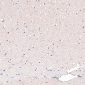 Monoclonal Anti-POU3F2 antibody produced in mouse Prestige Antibodies® Powered by Atlas Antibodies, clone CL6228, purified immunoglobulin, buffered aqueous glycerol solution