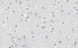 Anti-RNA polymerase II Antibody, clone CTD4H8 ZooMAb® Mouse Monoclonal recombinant, expressed in HEK 293 cells