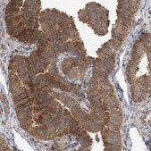 Anti-LATS1 antibody produced in rabbit Prestige Antibodies® Powered by Atlas Antibodies, affinity isolated antibody, buffered aqueous glycerol solution