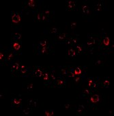 Anti-ATR antibody produced in rabbit purified antibody (Ion exchange)