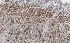 Anti-IKB α Antibody, clone 6O8, ZooMAb® Rabbit Monoclonal recombinant, expressed in HEK 293 cells