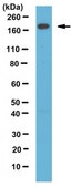 Anti-Telo-Collagen Type I, A1/COL1A1 from rabbit, purified by affinity chromatography